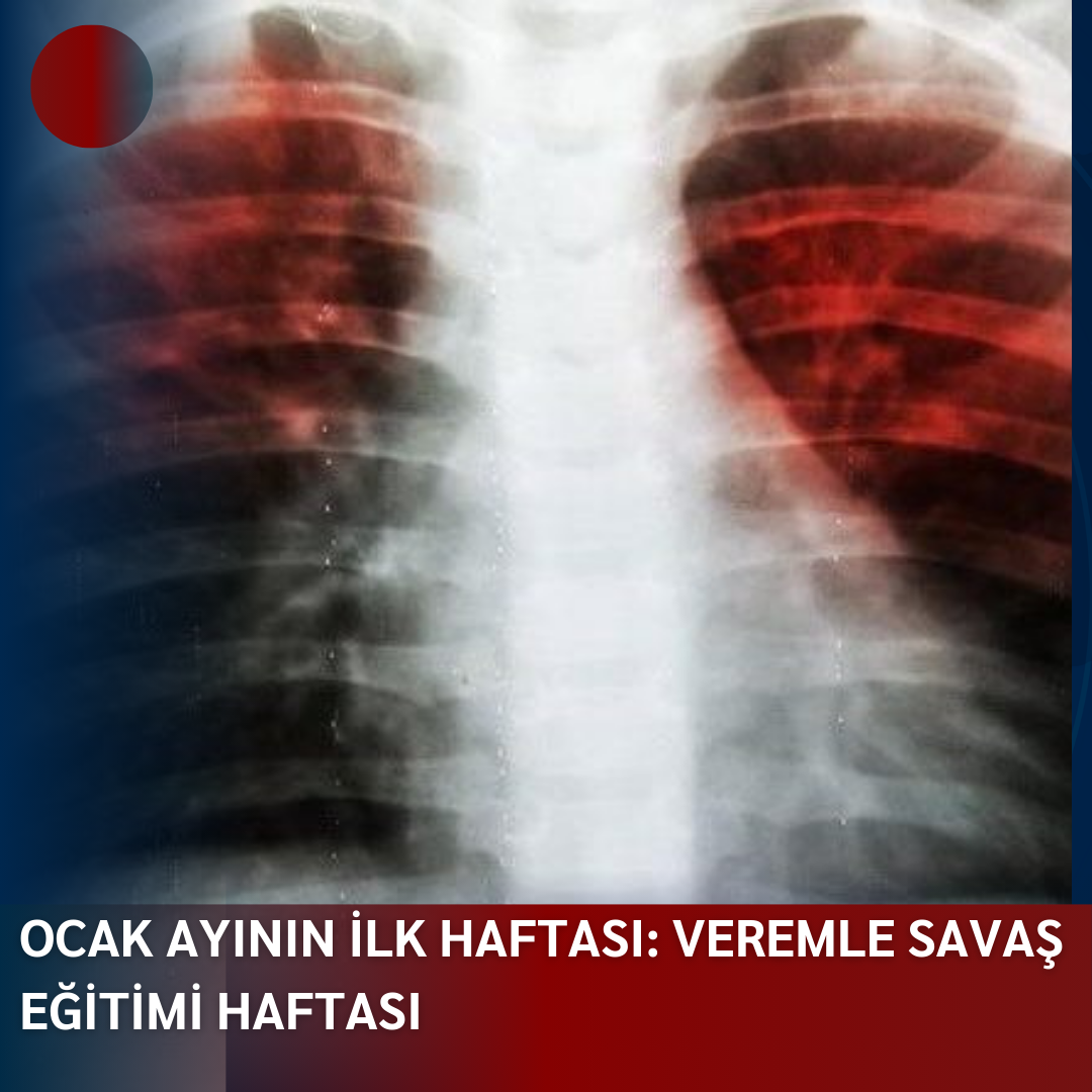 OCAK AYININ İLK HAFTASI: VEREMLE SAVAŞ EĞİTİMİ HAFTASI